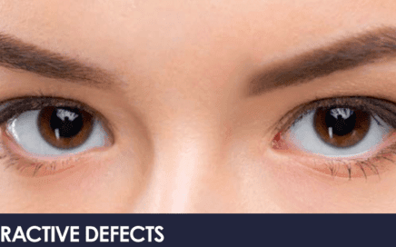 Refractive defects Myopia, hyperopia, and astigmatism 6 Refractive defects Myopia, hyperopia, and astigmatism 1