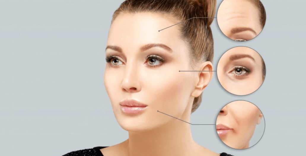 Botox (2) Botox 4